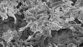 How cholera bacteria swap defenses against viruses